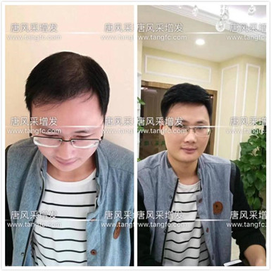 如何避免成為一個脫發(fā)的中年猥瑣男人？